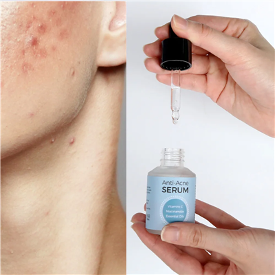 घोंघा सीरम