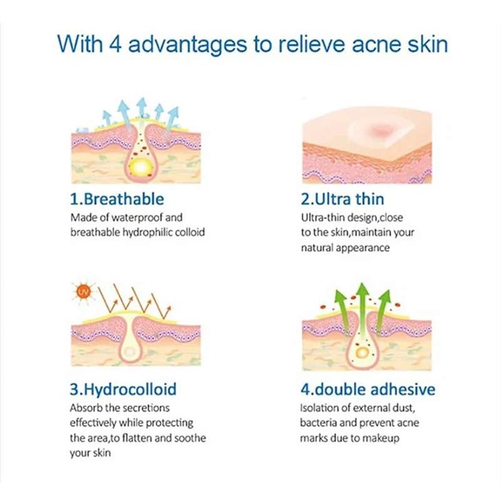 मुँहासे